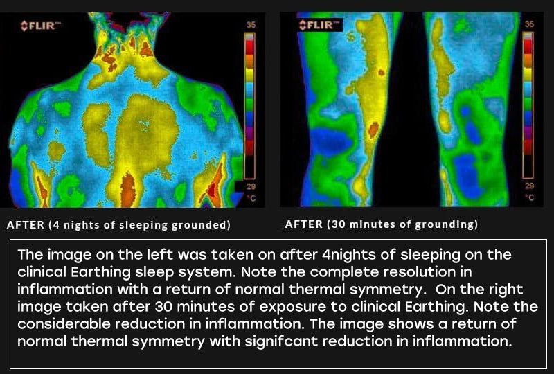 image comparison after